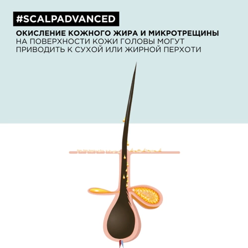 Шампунь от перхоти / SCALP ADVANCED 300 мл фото 6